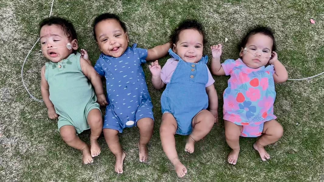 Thumbnail for Bryant Quadruplets: 115-Day Premature Birth Breaks World Record